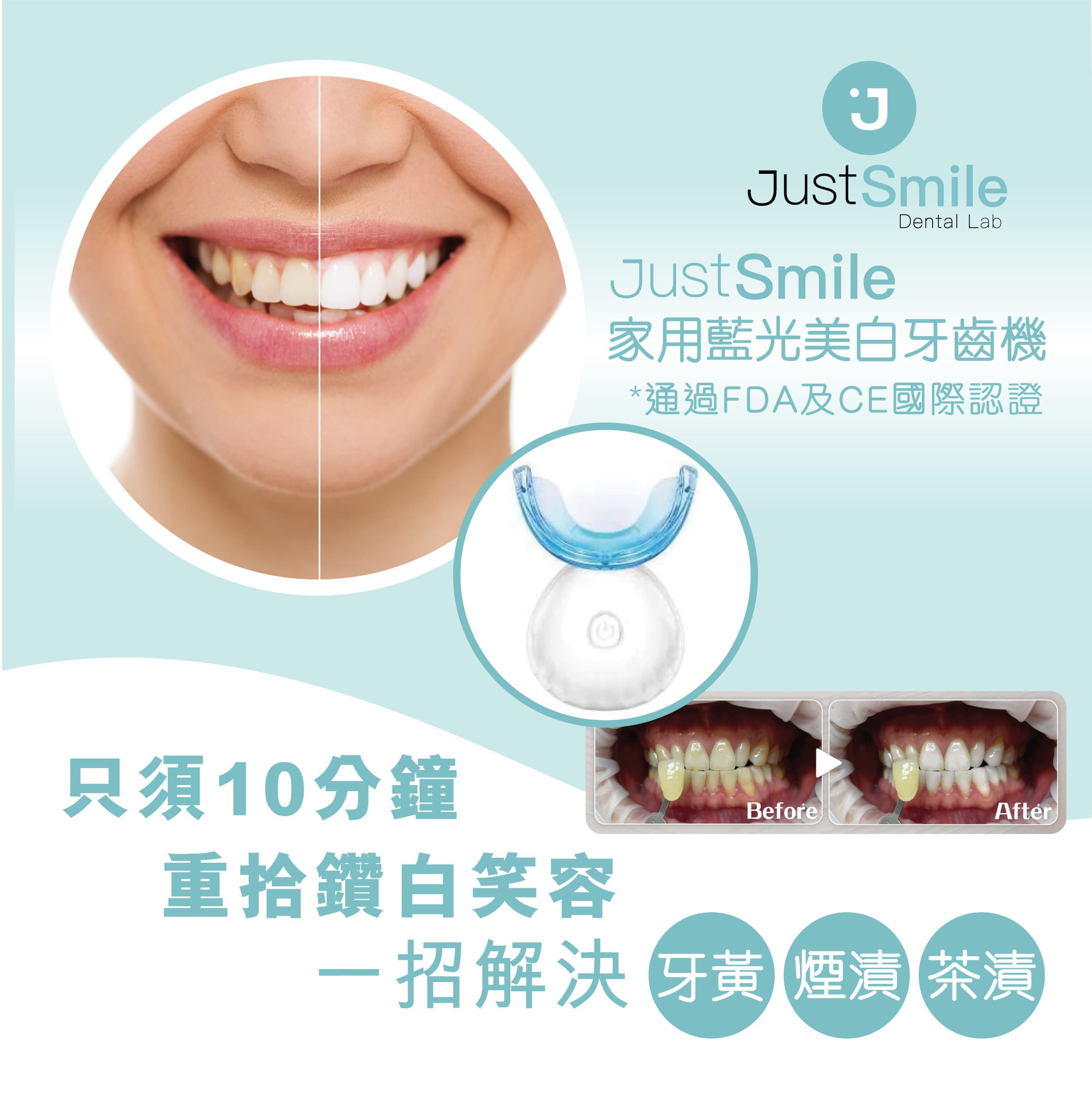 JustSmile 家用牙齒藍光美白套裝