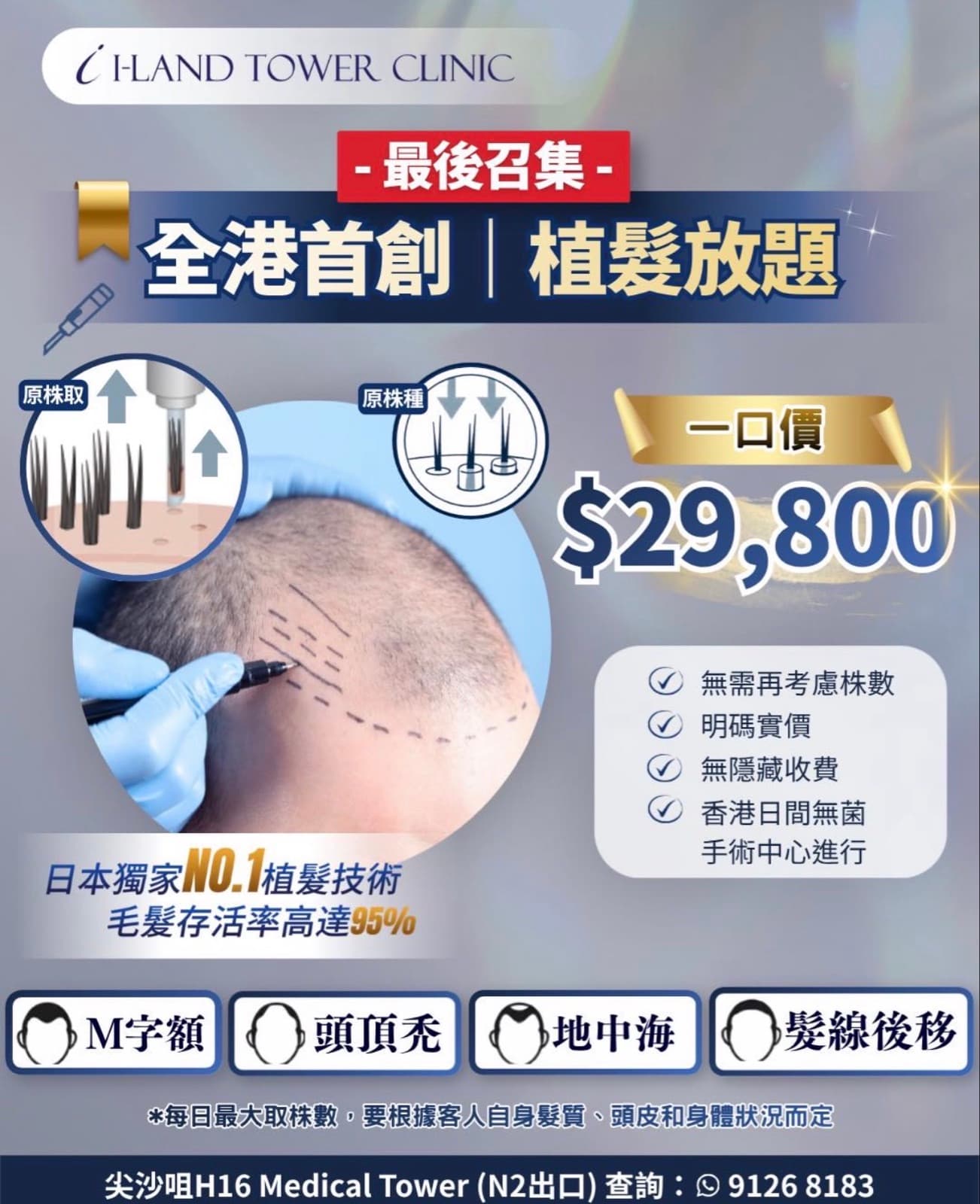 「植髮放題・唔使再數頭髮一口價」 $29,800 無限株植髮療程